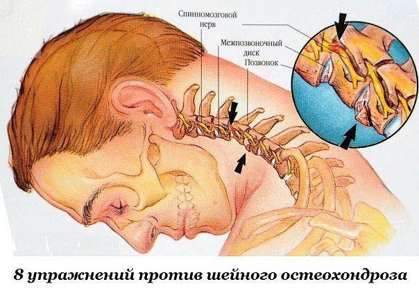 Черновик