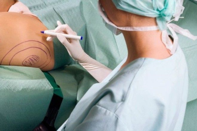 25 откровений пластических хирургов которые разрушают стереотипы 