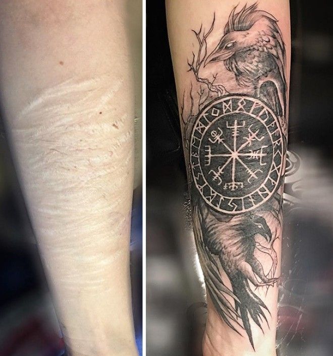 15 татуировок которые превратили шрамы в произведения искусства