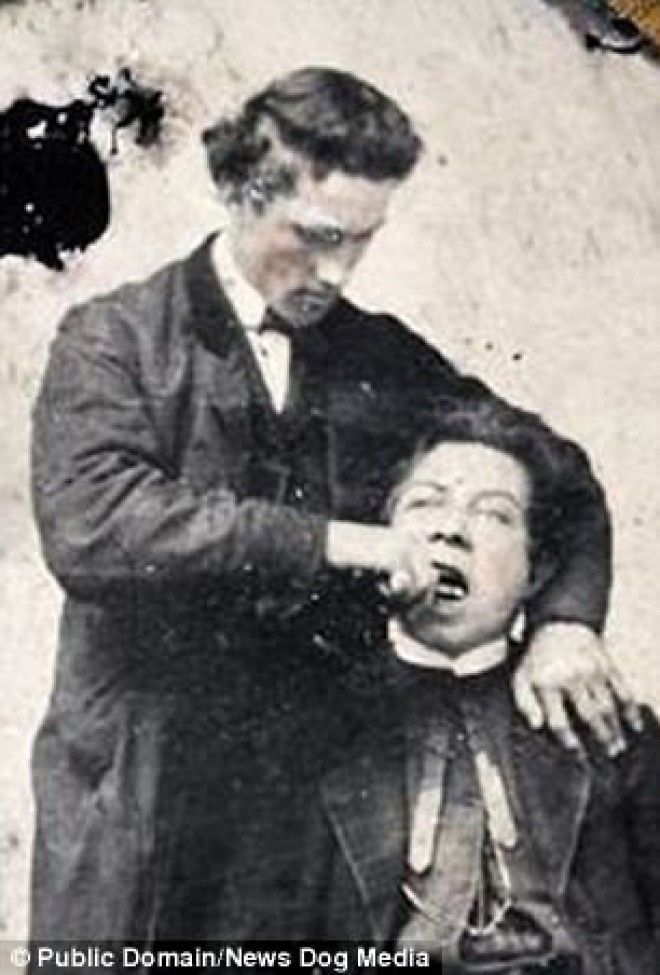 История стоматологов Слабонервным не смотреть 