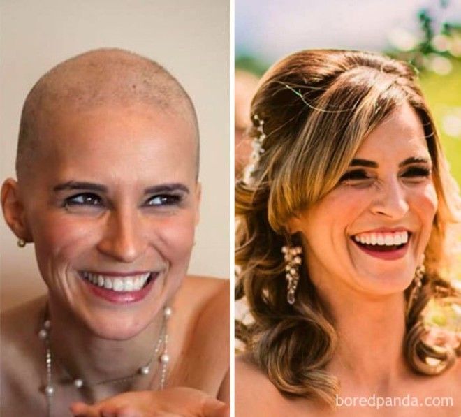 25 героев которые выиграли схватку с раком и теперь здоровы и счастливы