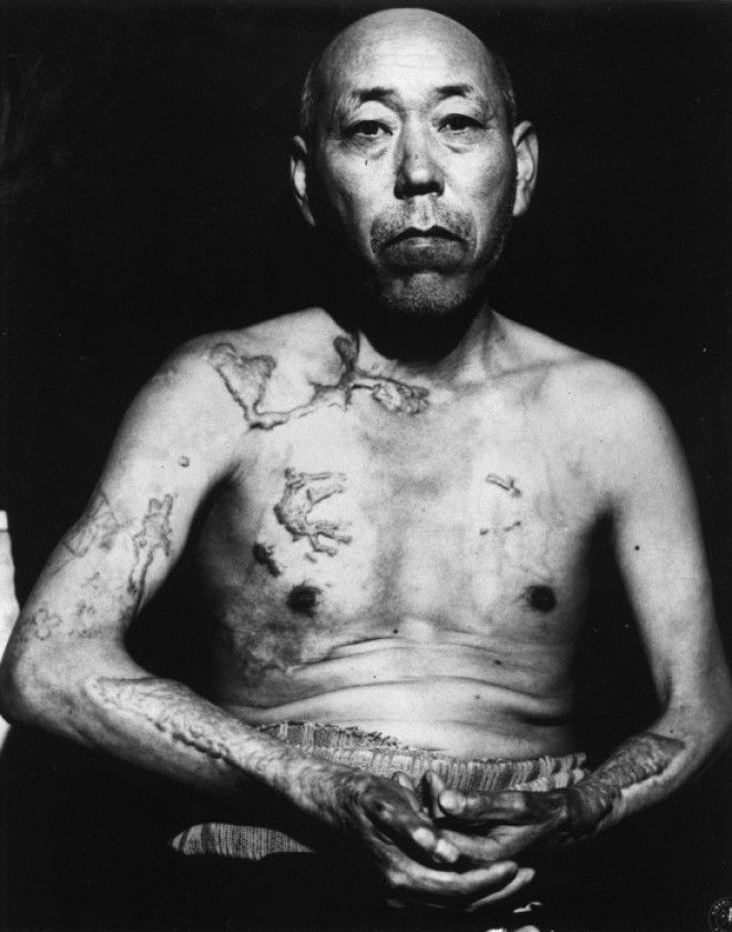Житель Хиросимы Теравама переживший атомную бомбардировку июнь 1945 года