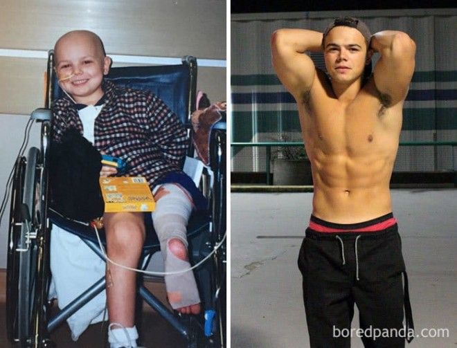 25 героев которые выиграли схватку с раком и теперь здоровы и счастливы