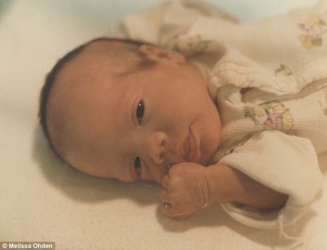 Маме сделали аборт но я выжила невероятная история Мелиссы Оден 
