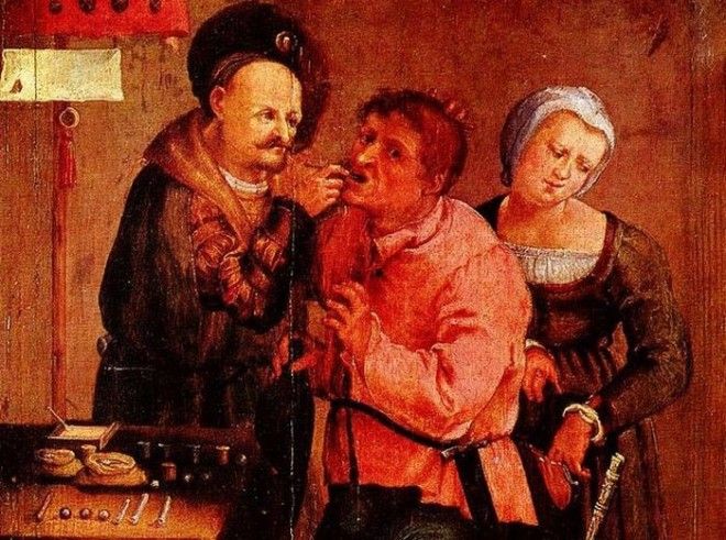 как лечили зубы в древности методы лечения зубов в средневековье