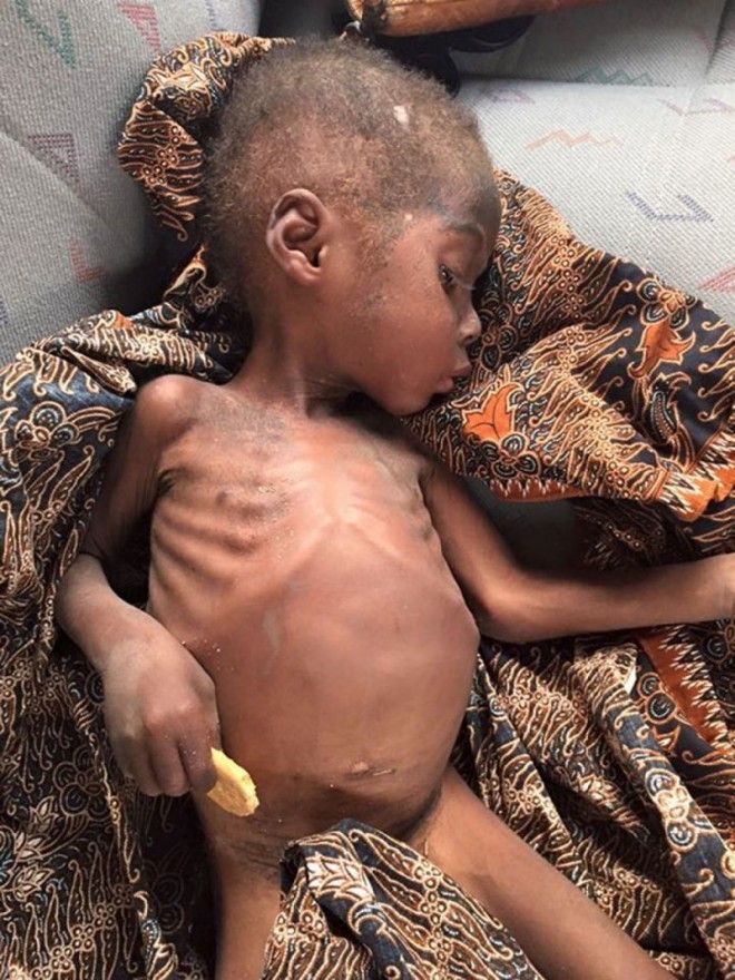 Картинки по запросу голодающий мальчик из Нигерии