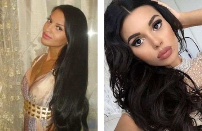 Российские звезды Instagram до и после пластических операций