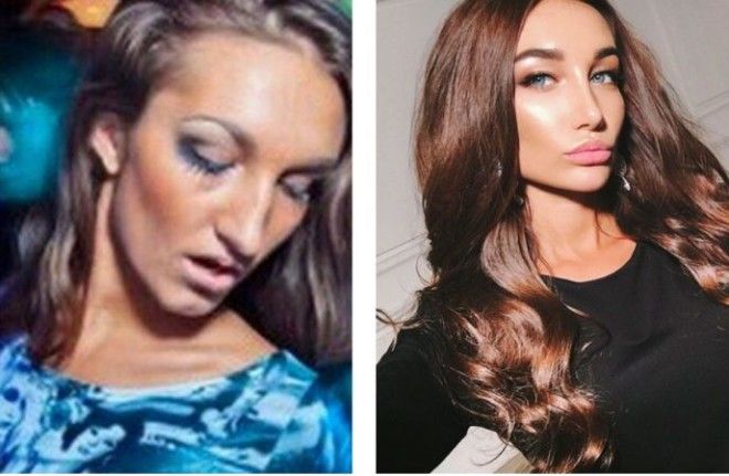 SСовершенно другое лицо 10 звезд российского инстаграма до и после пластики