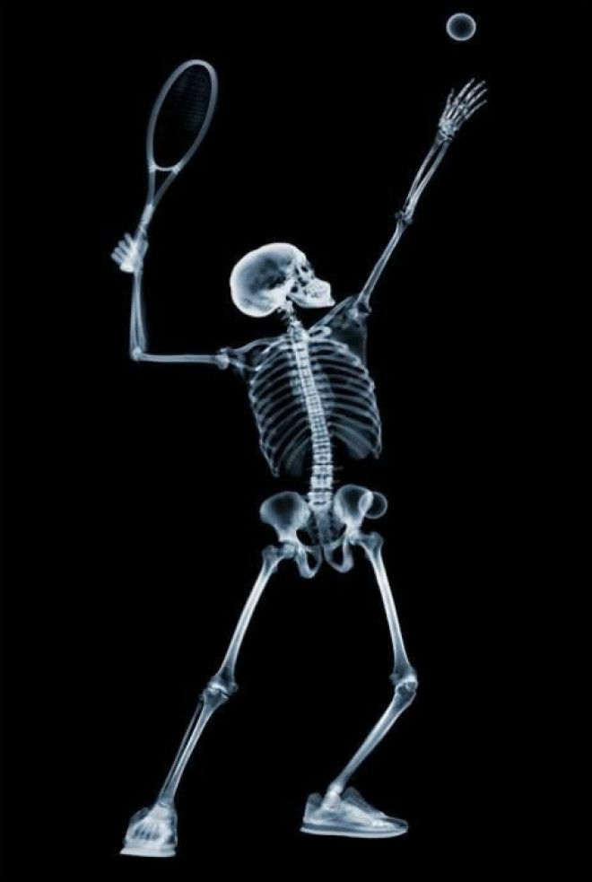 Теннисист в рентгеновской камере