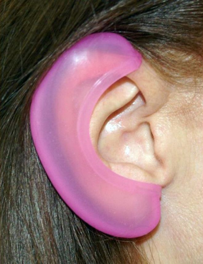 Защитные накладки на уши