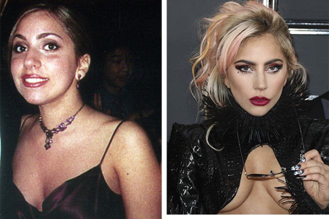 Sак выглядела Леди Гага до пластики тайнакоторую она не желает раскрывать