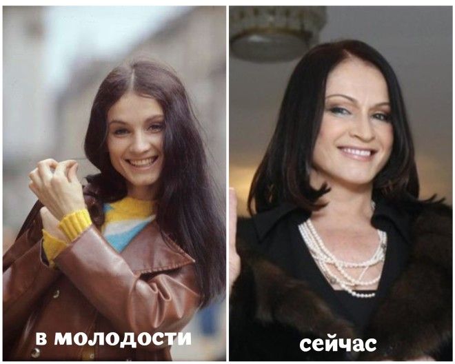 SВот как постарели российские звезды с начала своей карьеры