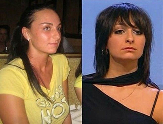 S9 российских знаменитостей которые похорошели после ринопластики