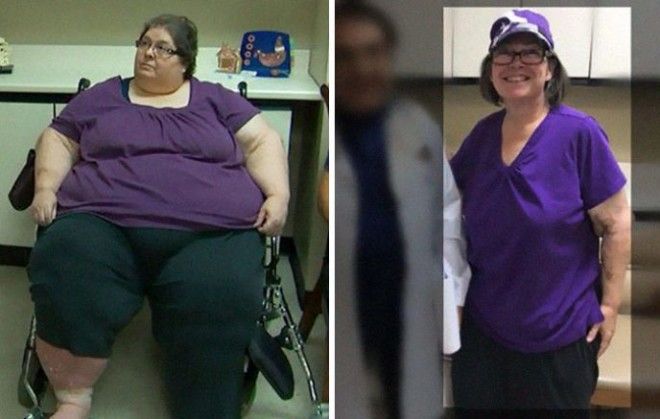 S14 фотографий До и После похудения Эти люди показали свою силу воли
