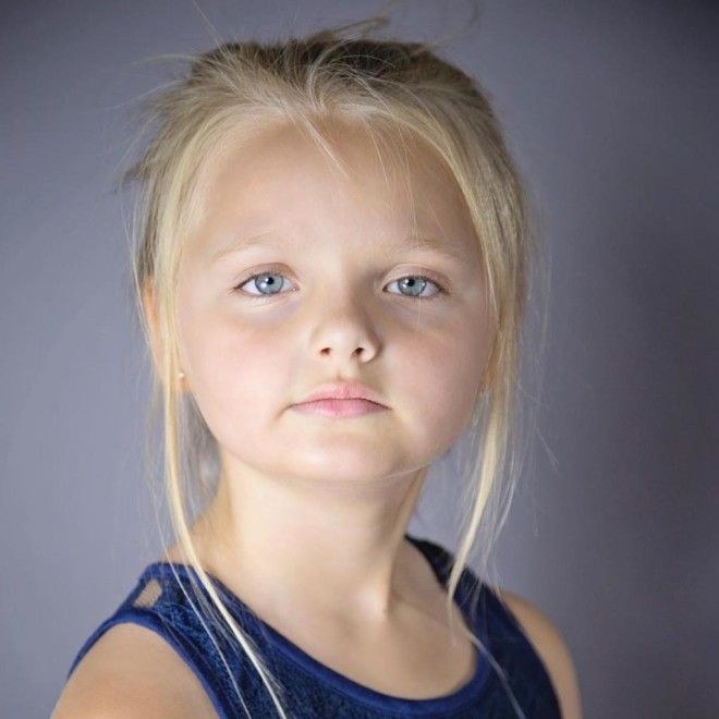 SBЧерез 7 лет малышка с ангельской внешностью утратила свою красоту