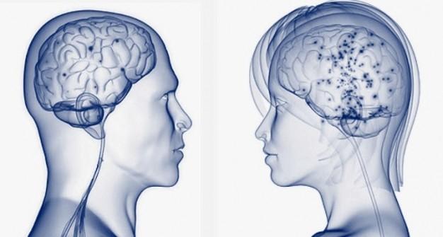 20 отличий между женским и мужским мозгом.